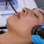 Bem Nux, radiofrecuencia